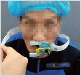 Disposable Medical Device, Endotracheal Tube